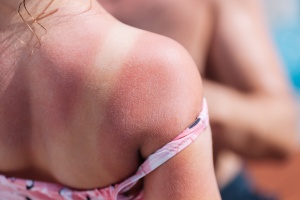 6 alapszabály, hogy ne égjen le a gyermeked bőre a napon