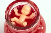 A magzat neme alapján végeznek abortuszt brit klinikákon